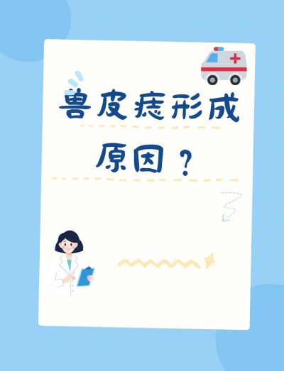 兽皮痣是怎么形成的？